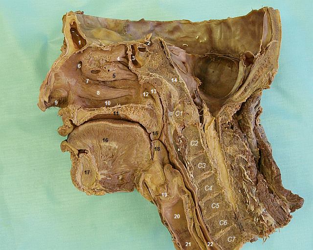 Sagittal section of head