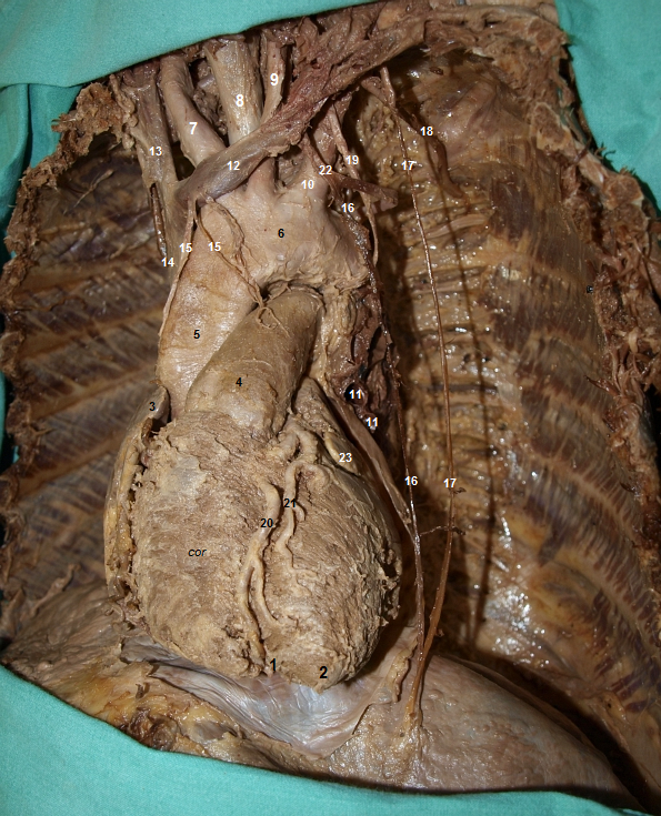 Pohled na orgny hornho a stednho mezihrud (pohled zleva)