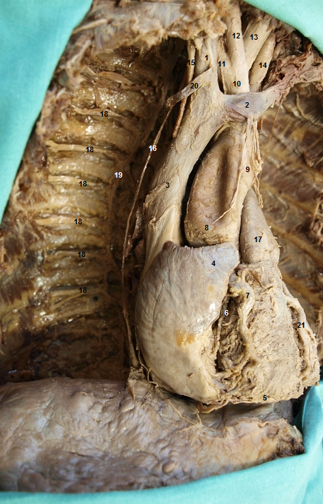 Pohled na orgny hornho a stednho mezihrud (pohled zprava)