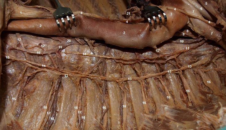 Pohled na orgny zadnho mezihrud (pohled zleva)