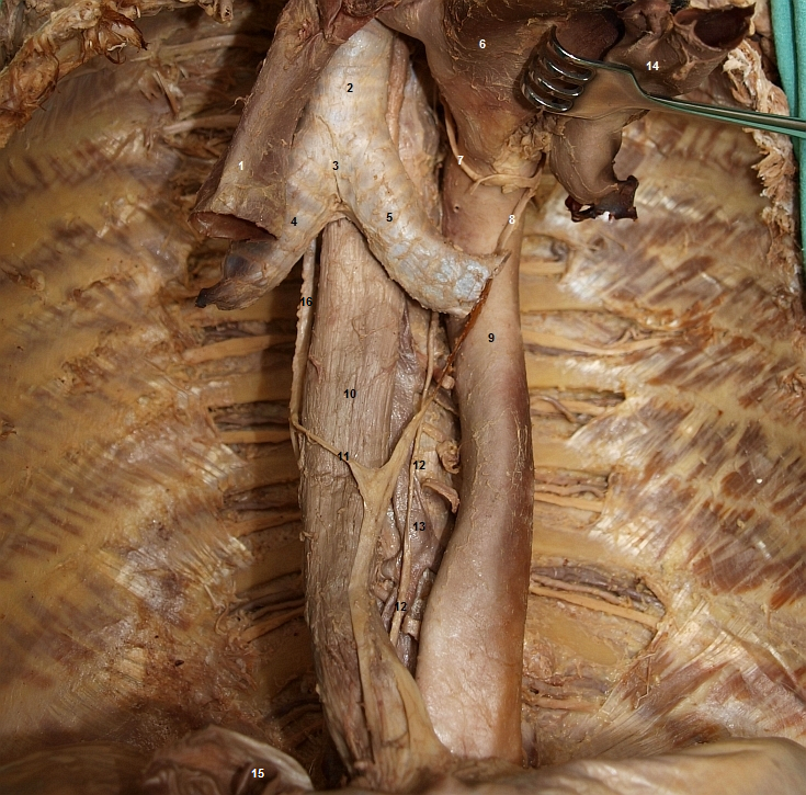 Pohled na cvy a orgny mezihrud (oblouk srdenice odklopen)