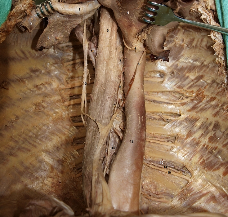 Cvy a orgny mezihrud (oblouk srdenice a prdunice odklopeny)