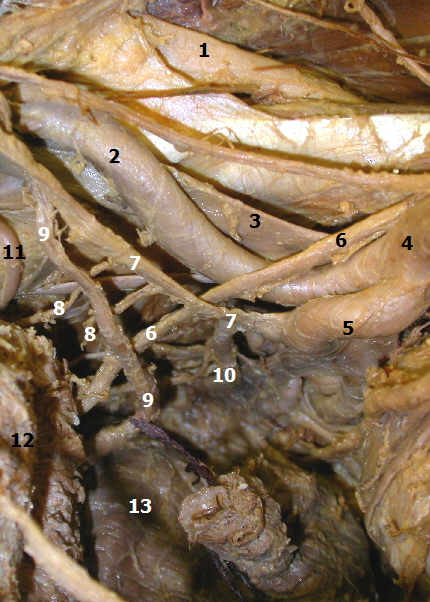 Pohled do mal pnve (♂) zleva na vtve a. iliaca dx.