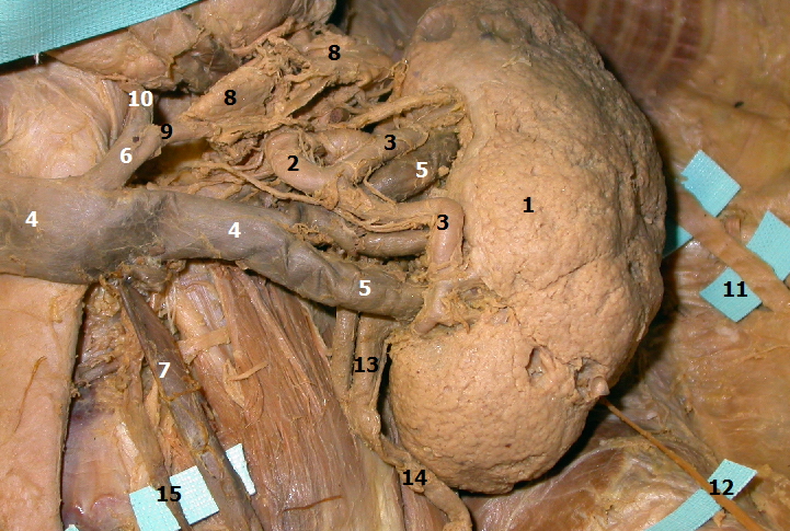 Pohled na levou ledvinu a jej okol