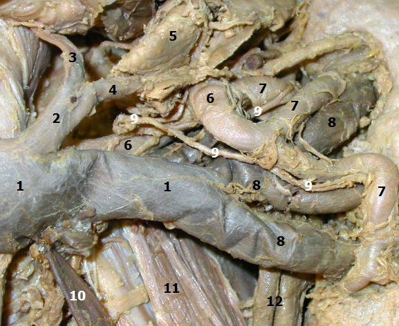 Detailn pohled na hilum renale vlevo