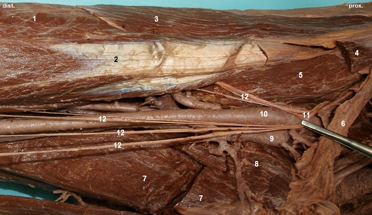 Fossa iliopectinea (pehled cv a nerv)