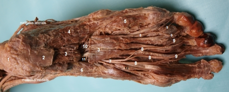 Plantrn strana nohy (pehled tvar)