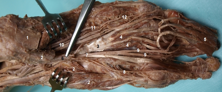Detailn zobrazen plantarnch cv a nerv