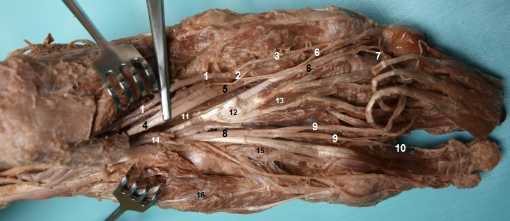 Detailn zobrazen plantarnch cv a nerv (2)