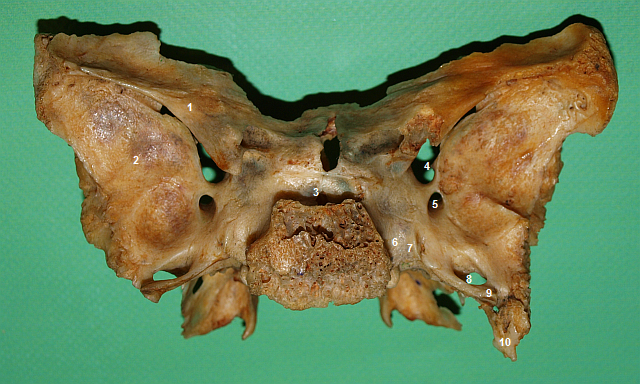 Klnov kost (shora a zezadu)