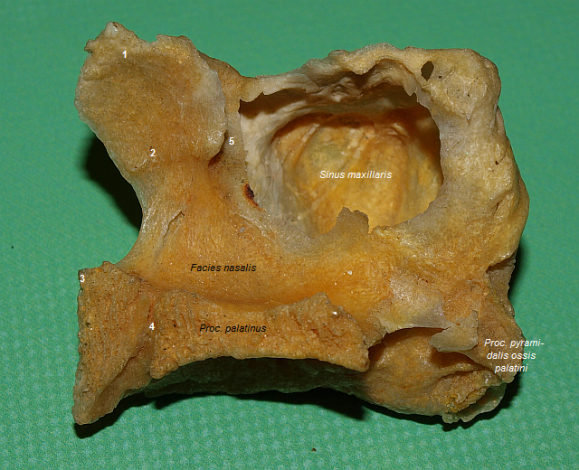 Prav maxilla (mediln strana)