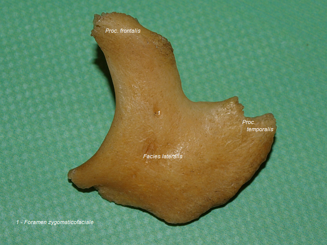 Lcn kost (lev, zevn strana)