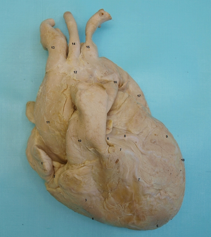 Celkov pohled na srdce a vtve oblouku aorty (zepedu)